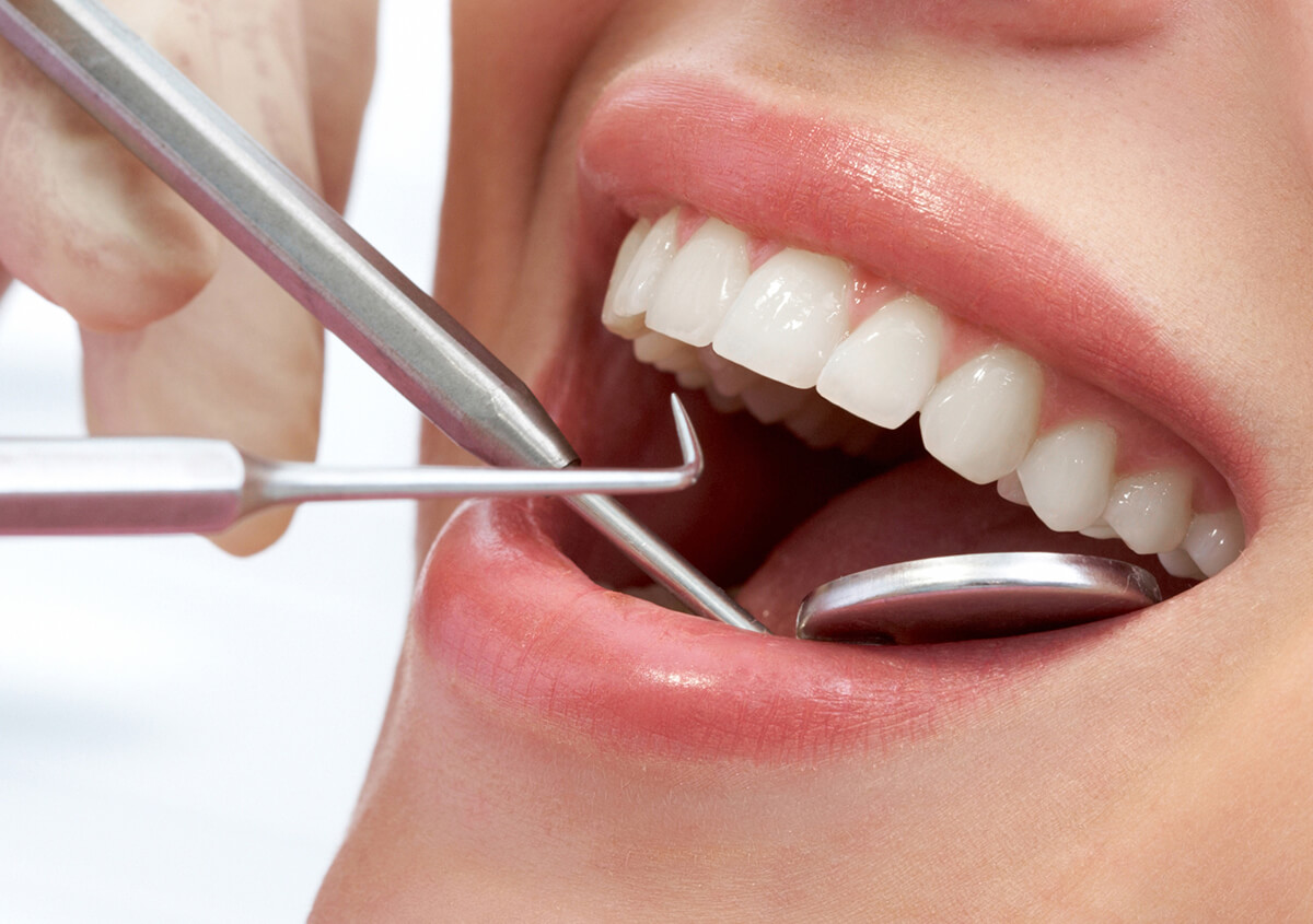 Is Gum Disease Troubling You? Here is All You Need to Know Before Seeking Periodontal Disease Treatment