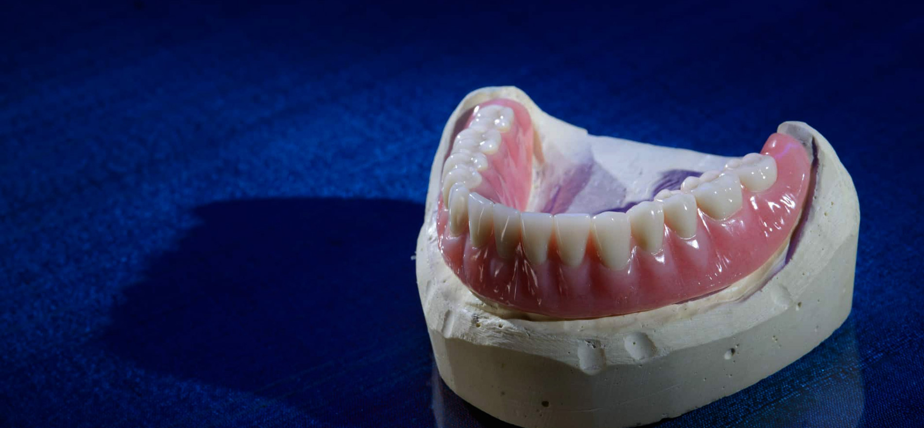 Planning and Providing practival overdenture solutions